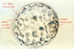 【优生】三代试管遇上嵌合体胚胎，是丢弃还是移植？